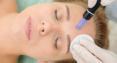 Micro needling